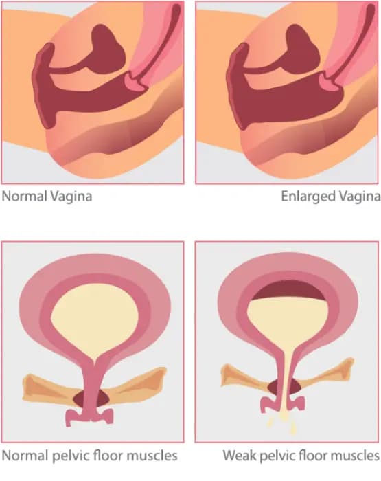 vagina